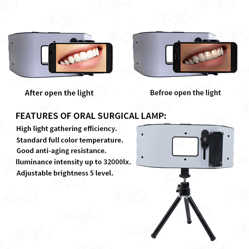 Luz de Flash Dental, equipo de - Photography Lighting Flash reseña y precio